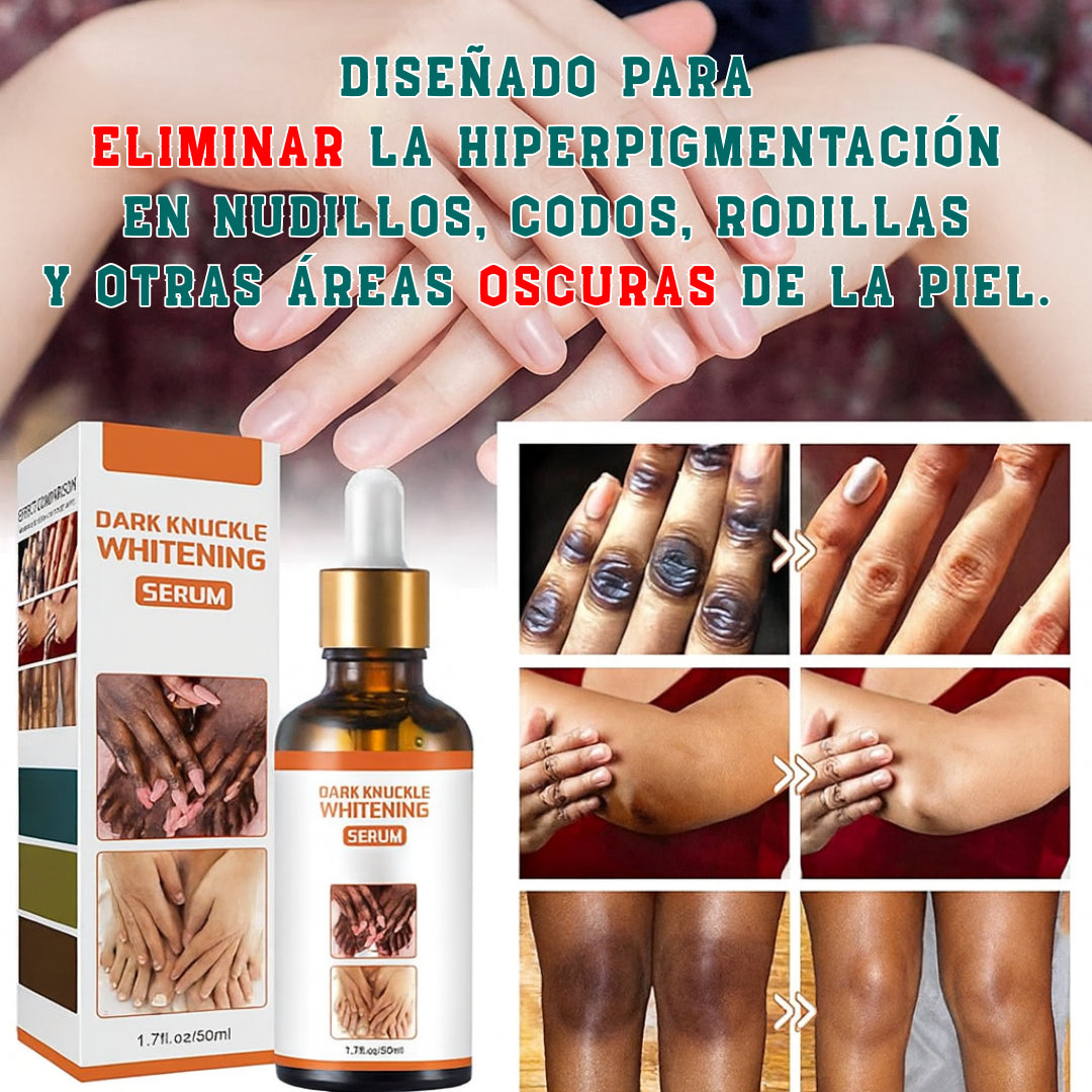 Sérum Despigmentante | Unifica el tono de la piel de forma Natural | Dark Knuckle Whitening ®