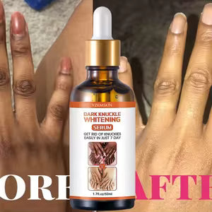Sérum Despigmentante | Unifica el tono de la piel de forma Natural | Dark Knuckle Whitening ®